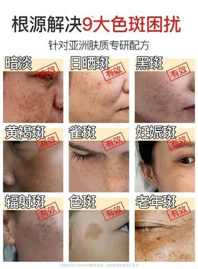 美白祛斑b3精华液维生素b3