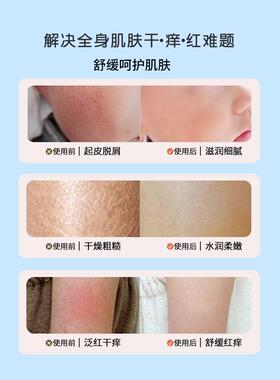 儿童专用维e乳维生素e乳正品官方