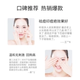 Венсин Шаян мозговой свет для удаления команды ∮ Ремонт кальция и официальные продукты