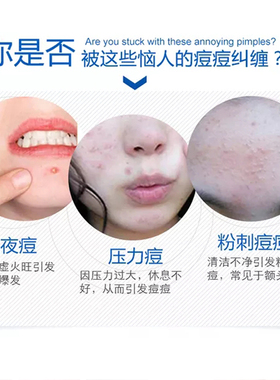 水杨酸控油闭口粉刺女士面膜