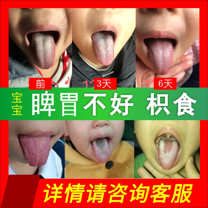 健脾养胃婴幼儿调理脾胃宝宝舌苔厚内热胀气厌食寒湿重消积食草本 - 图1