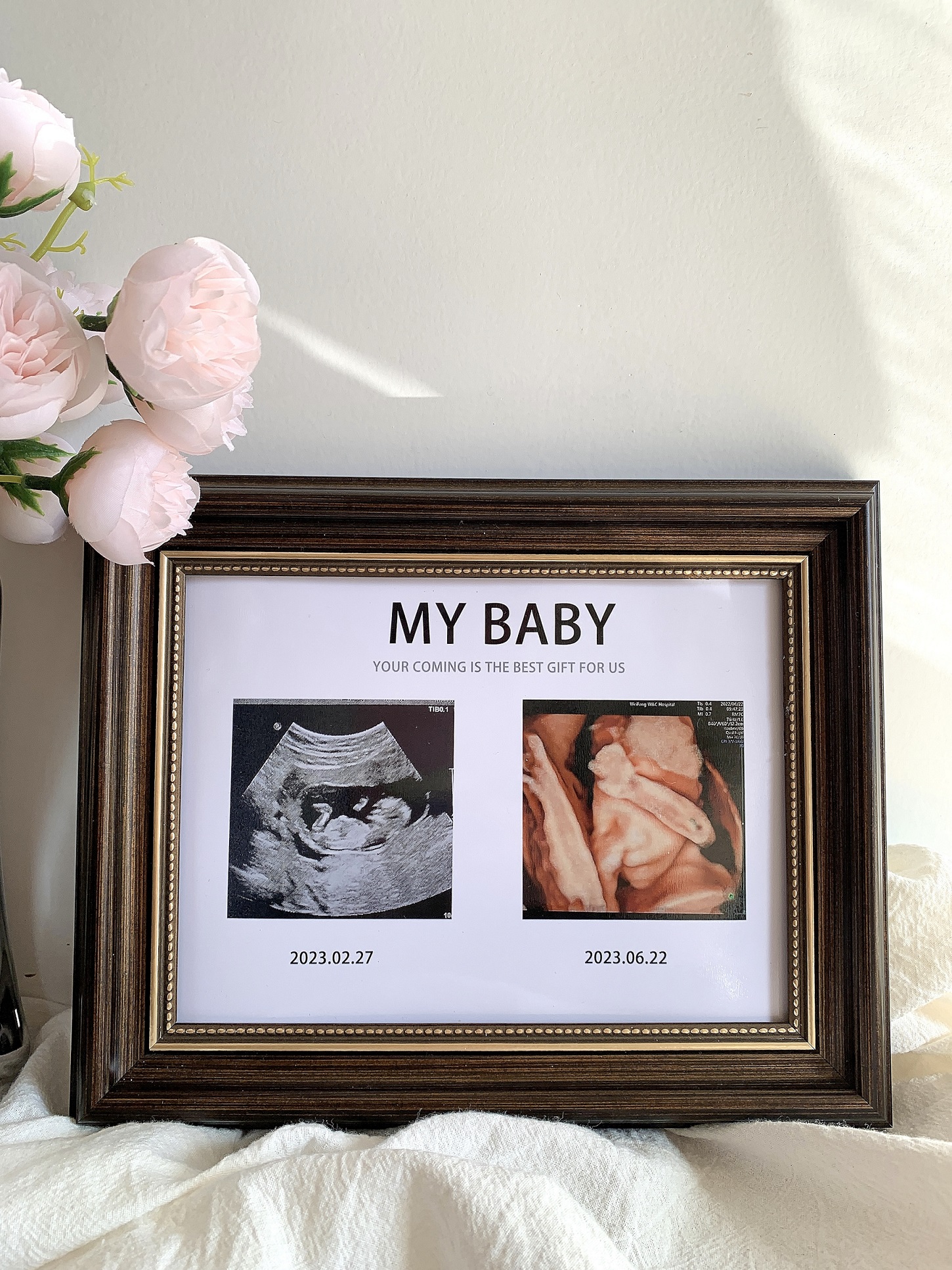宝宝四维照片相框孕期NT B超图打印婴儿出生礼物摆台纪念照 - 图0