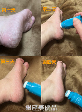 娜丽丝脚部美容液30ml足部护理精华/滋润保湿/手肘/足跟角质护理