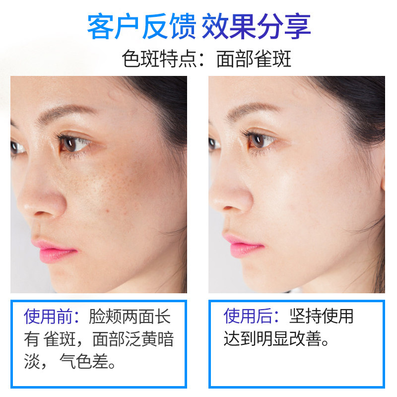 靓邦素正品美白神器去黑色素祛斑霜 靓邦素化妆品乳液/面霜