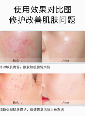 她青春神经酰胺冻干粉修护屏障