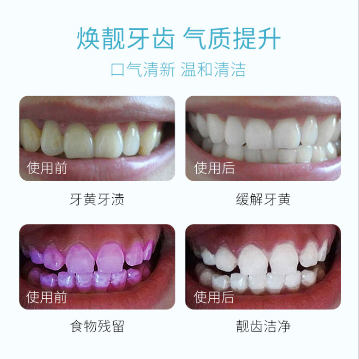 益生菌漱口水杀菌除口臭牙结石便携一次性小包装男生女生持久留香,淘宝优惠券,粉丝福利购,淘宝优惠卷