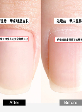 进口金刚砂美甲俄式通用打磨头
