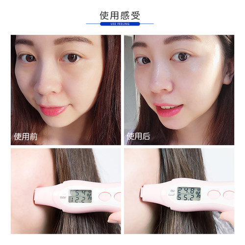 容太太韩国ahc玻尿酸乳液B5高保湿补水清爽秋冬滋润孕妇可用140ML - 图0