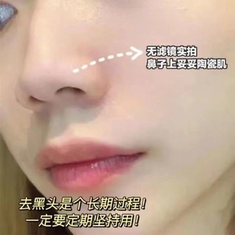 【学生护肤】免撕除黑头鼻贴导出收缩清洁毛孔三件套祛黑头去粉刺