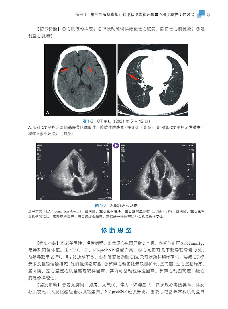 心血管临床精彩病例荟萃鄢华宋丹绍心血管疾病诊治的精彩案例46例附有相关视频病例报道诊断思路病例讨论经验总结科学出版社 - 图1