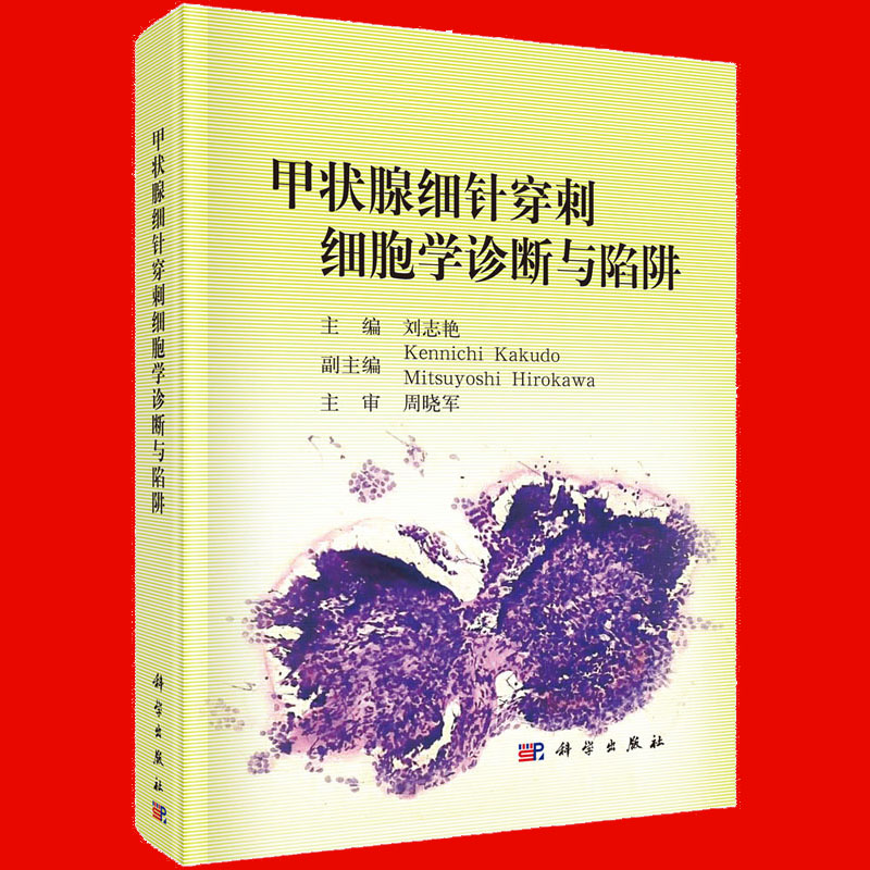 【正版现货】甲状腺细针穿刺细胞学诊断与陷阱 刘志艳主编 甲状腺疾病,活体组织检查,细胞诊断 科学出版社 - 图2