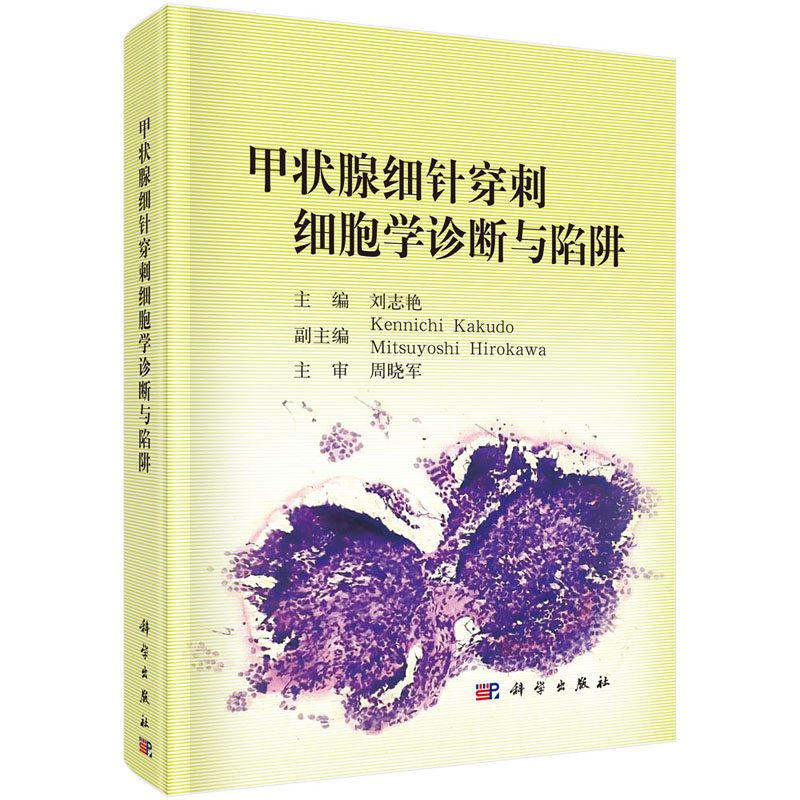 【正版现货】甲状腺细针穿刺细胞学诊断与陷阱 刘志艳主编 甲状腺疾病,活体组织检查,细胞诊断 科学出版社 - 图0