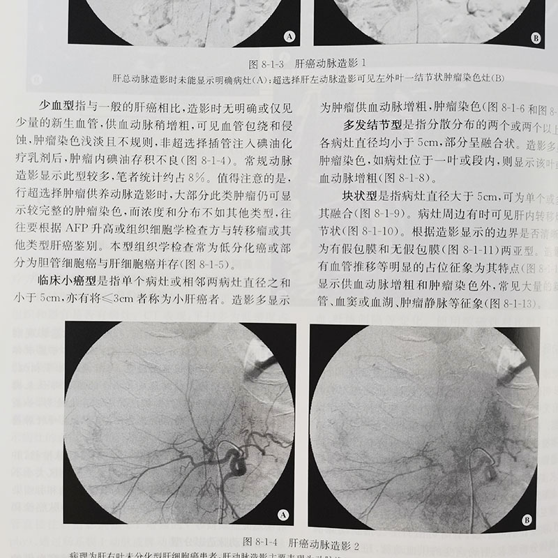 【正版现货】实用临床介入诊疗学图解（第三版）第3版 李彦豪.何晓峰.陈勇等 科学出版社 介入科医师.影像科医师等临床医师书籍 - 图2