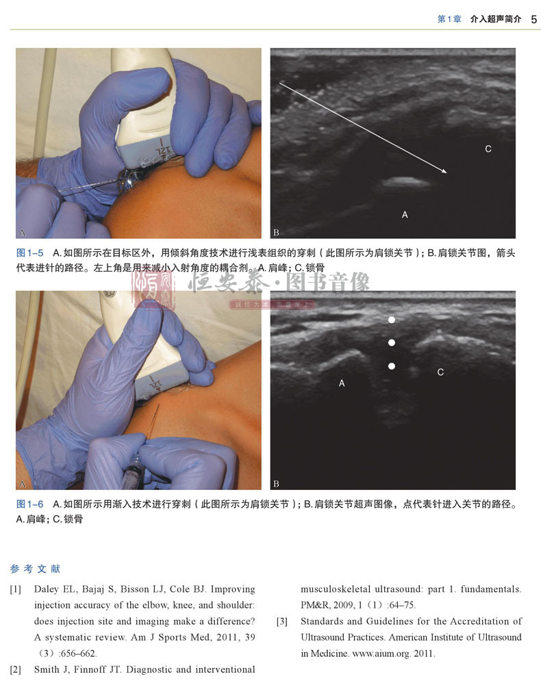 超声引导下肌骨介入治疗 杰德拉.马兰加 编 超声科骨科医用书 肌骨超声 肌骨超声诊断学 肌骨超声入门 肌肉骨骼系统超声医学 - 图2