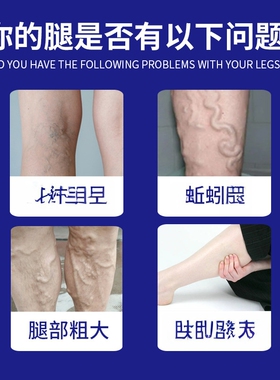 日系香草雨露静脉康舒膏青筋突出蚯蚓腿腿部小腿脉管曲长不适药膏