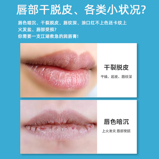 Baileish blistex small blue jar lip balm lipstick lipstick mask