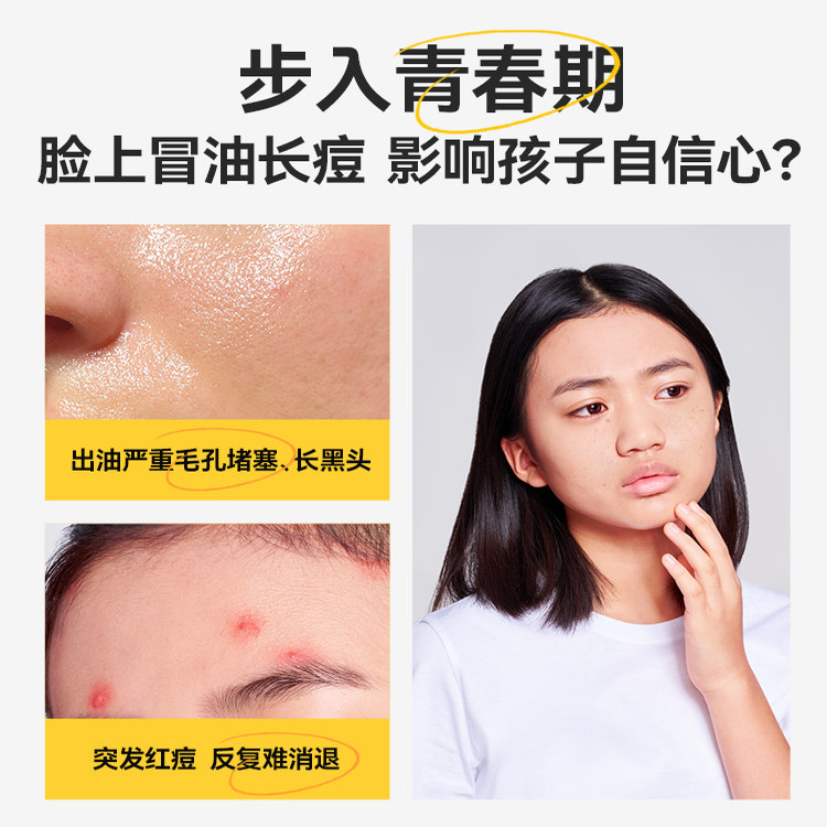 郁美净青少年护肤品套装控油祛痘儿童洗面奶精萃水乳痘痘闭口,淘宝优惠券,粉丝福利购,淘宝优惠卷