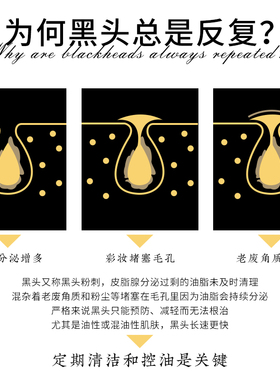 黑头吸尘器祛黑头收缩毛孔清洁