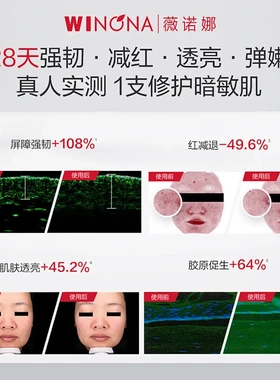薇诺娜第二代30ml舒敏保湿特护精华液舒缓敏感肌肤补水保湿退红