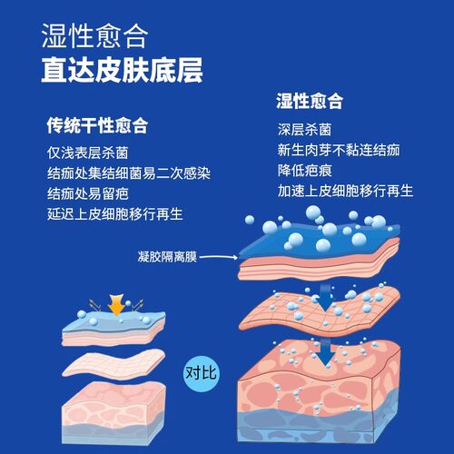 可鲁复合溶菌酶抗菌凝胶皮肤创伤细菌真菌伤口消毒手术后抑菌 - 图1