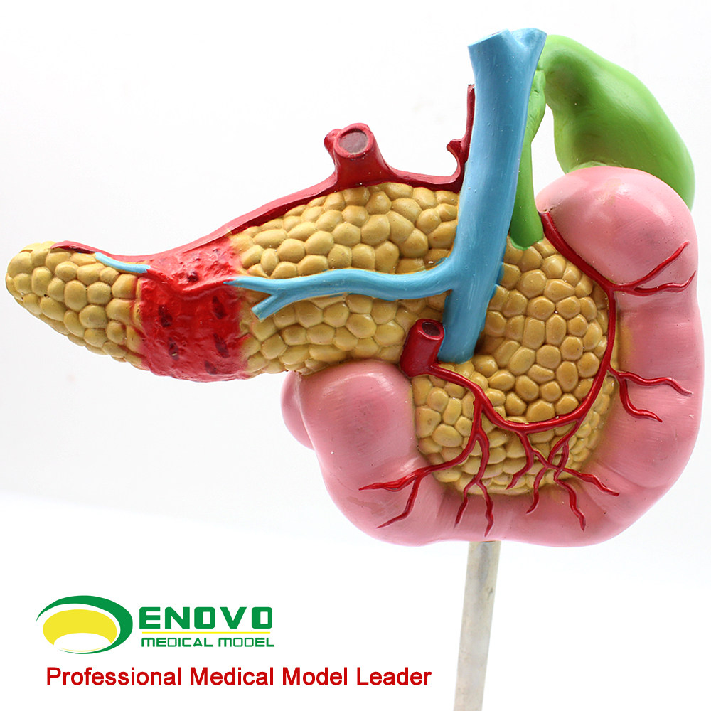 ENOVO颐诺医学胰腺十二指肠胆囊病理模型外科消化科系统模具肝胆科模型专科医生医学住院医师教学上海教具,淘宝优惠券,粉丝福利购,淘宝优惠卷