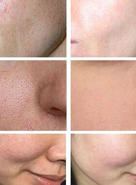 Lactobionic Acid Serum Shrink Pores Moisturizing Essence Liq