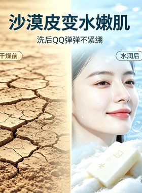 白牡丹凝脂皂舒缓干敏改善暗沉