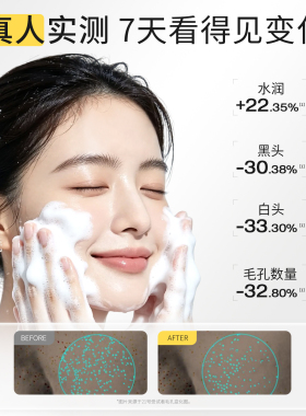 羽素控油祛痘洁面慕斯控油舒缓