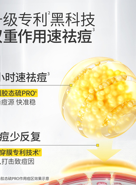 羽素胶态硫祛痘大灯泡精华液