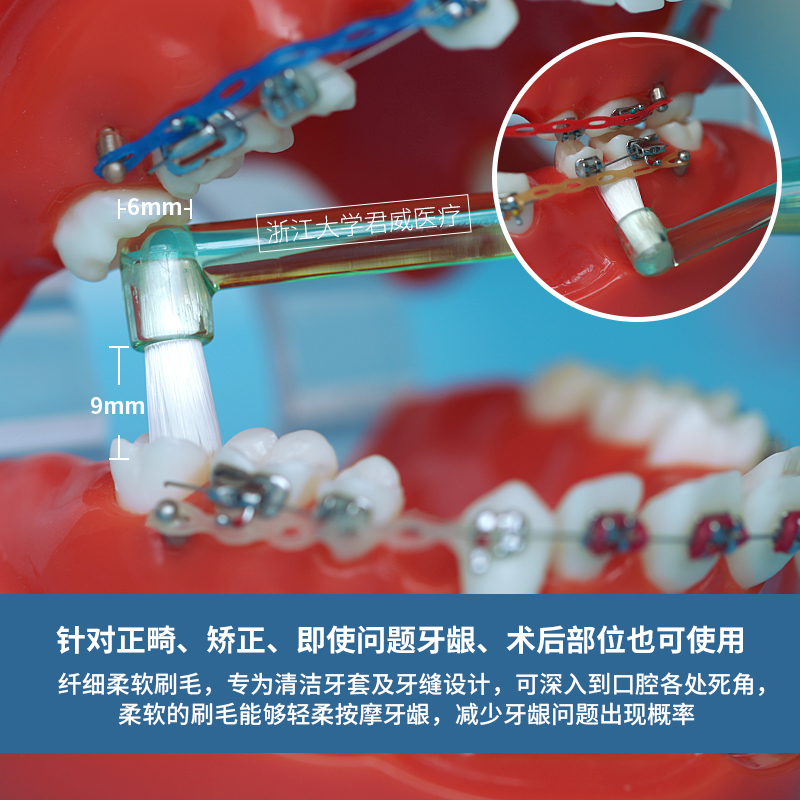 宠物牙刷ci日本进口单束正畸牙套矫正牙刷尖头成人软毛小头智齿