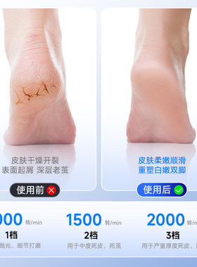 日本进口新款电动磨脚神器