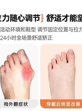 日本拇指外翻矫正带关节固定绷带肌肉贴大脚趾防磨护套透气可穿鞋