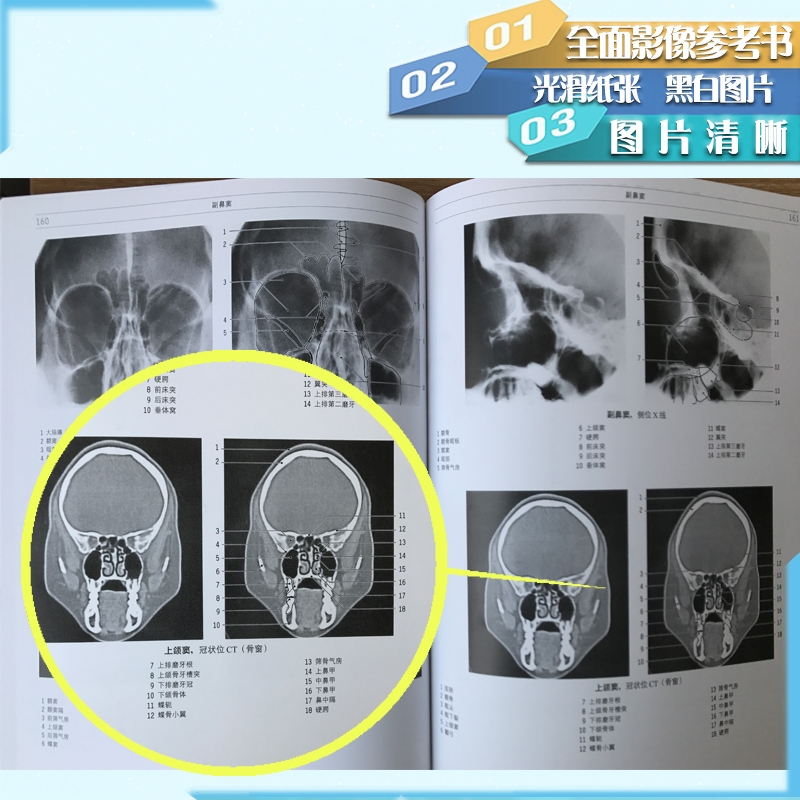 包邮正版 影像解剖学 医学影像诊断学 X线、CT、磁共振MRI、超声波、核素扫描 影像解剖 影像医学书 解剖学图谱 临床医学书籍 - 图0