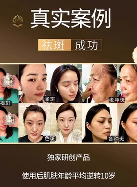 【长斑显老就用】贵妇祛斑膏祛黄褐斑老年斑雀斑晒斑美白去黄面霜