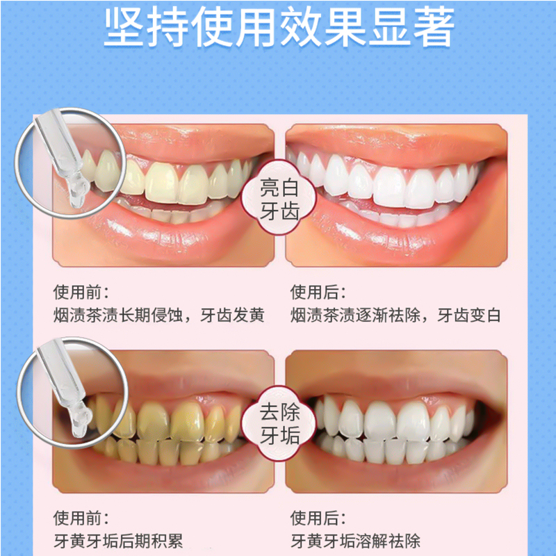 告别大黄牙~日本Tooth Pro牙齿速效美白液体牙膏烟渍黄口臭白牙素