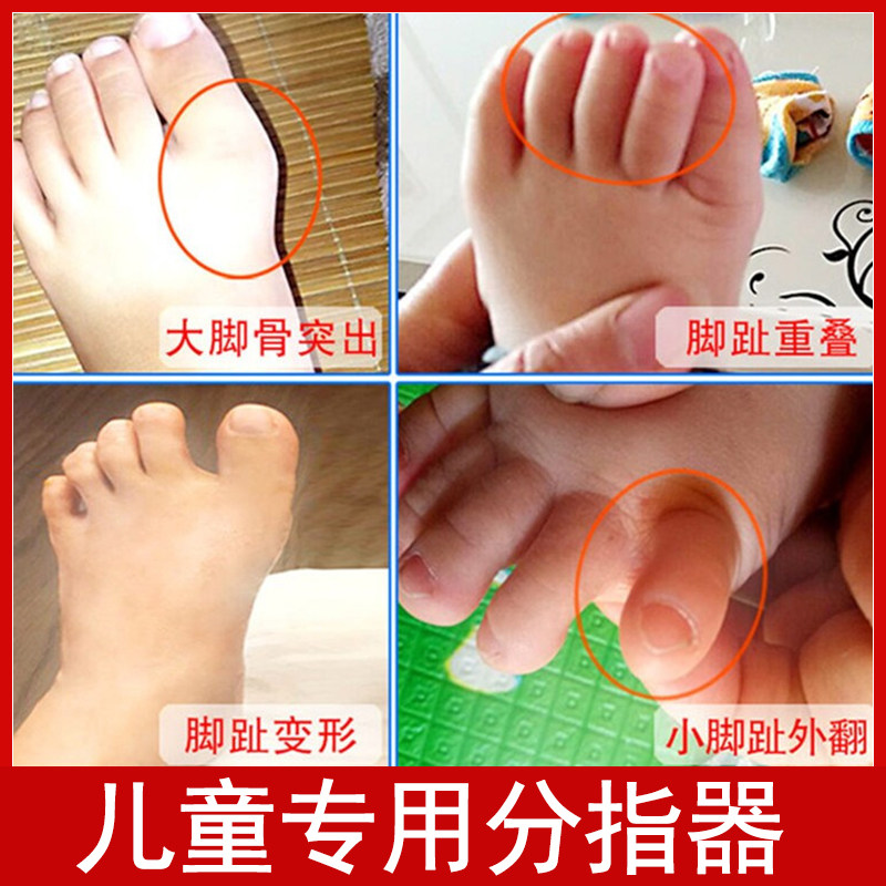 拇趾外翻小趾内翻 新人首单立减十元 21年7月 淘宝海外