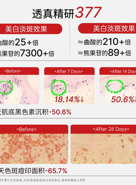 透真3577美白淡斑乳液 抗氧去黄提亮暗沉黄褐斑淡斑霜 烟酰胺黑色