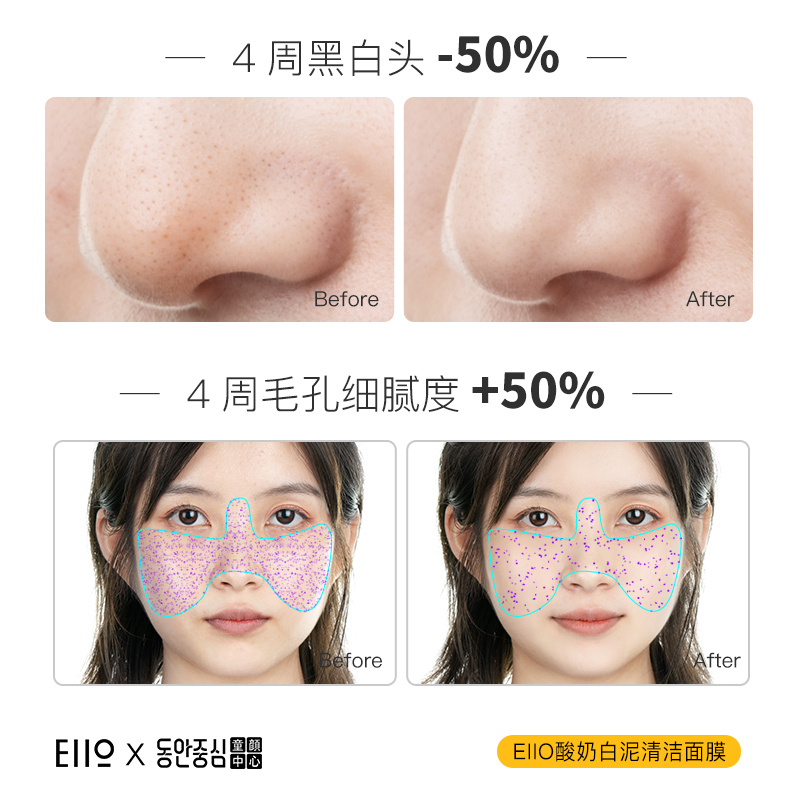 eiio清洁面膜泥膜女涂抹式补水保湿粉刺深层收缩毛孔临期清仓8月-图2