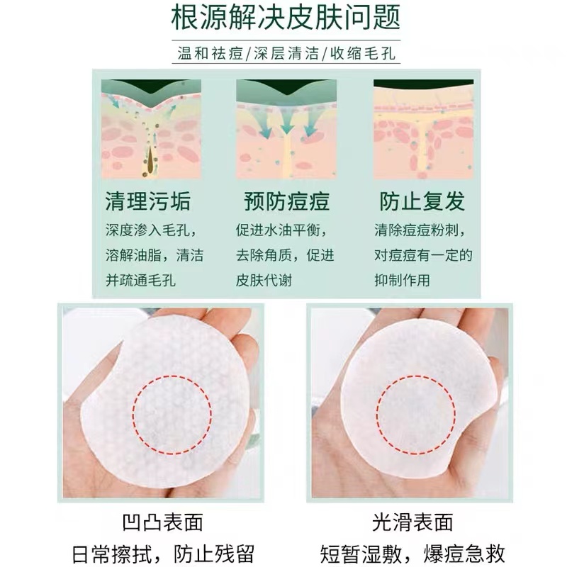 美国stridex水杨酸棉片祛痘痘印酸去闭口粉刺黑头清洁毛孔刷收缩 - 图1