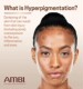 New version of American AMBI fade cream to fade, brighten, sunburn, spots and acne marks AHA cream 30ml