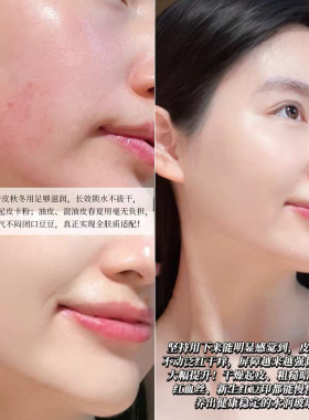 DR.URUR院线水光霜急救修护