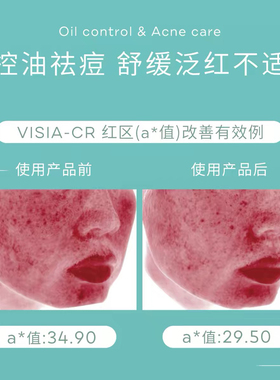 TOPIX绿茶舒缓控油保湿喷雾