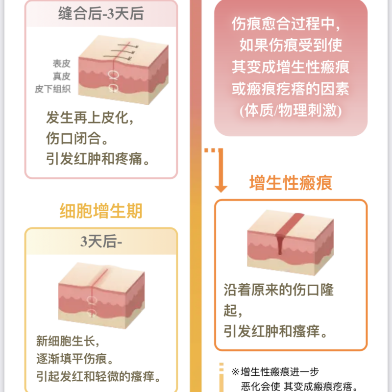 日本爱托美减张贴手术修复剖腹产疤痕贴医用弹力贴布L6片现货-图2