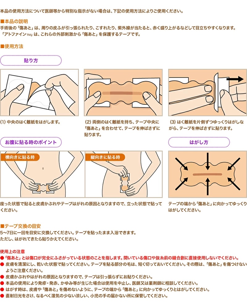 日本爱托美减张贴手术剖腹产护理专用医生推荐六片10-15厘米 - 图2