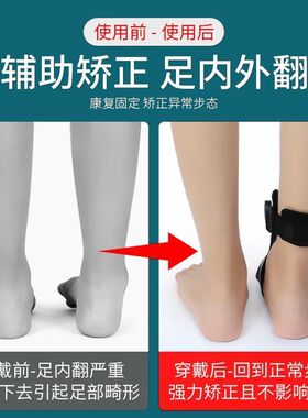足内翻脚外翻矫正器足托足下垂训练器中风偏瘫康复固定支具矫形鞋