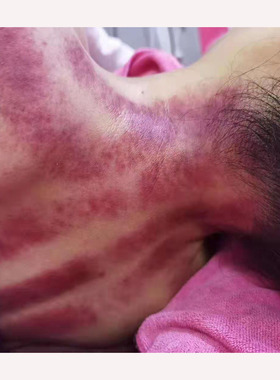 美容院养生艾灸按摩精油