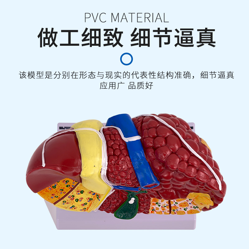 彩色肝脏模型常见临床病理特征医生用医患沟通硬化脂肪炎肝胆内科 - 图2