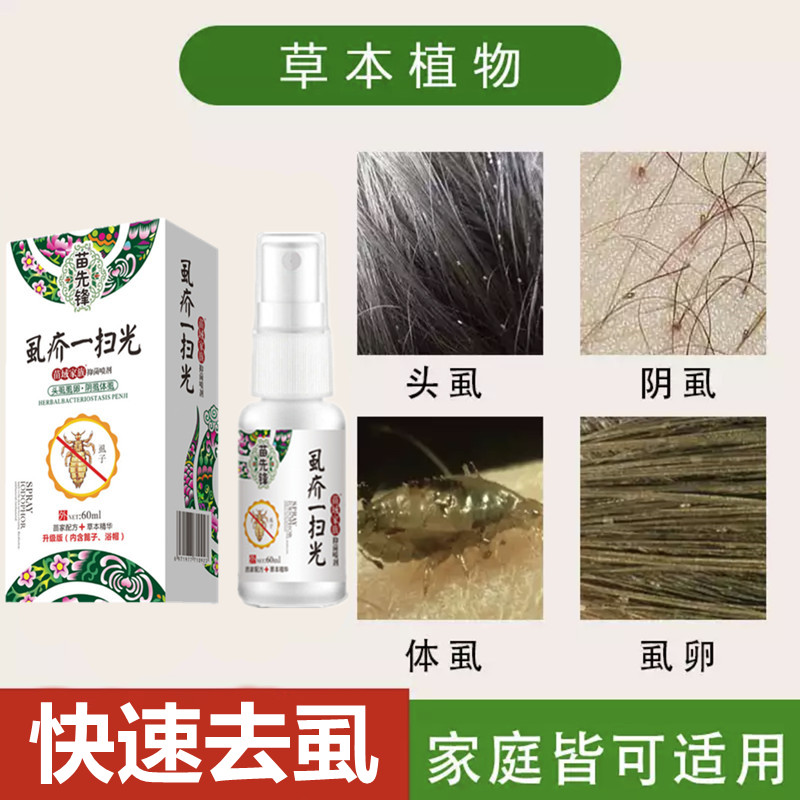 长头虱子药强效儿童头上小女孩头发狮子跳蚤头药虫卵双杀去除虱卵