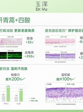 玉泽清痘调护平衡乳敏感控油祛痘