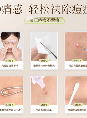 美容院专用去黑头挤压棒粉刺针